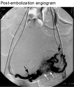 postang.jpg (17899 bytes)